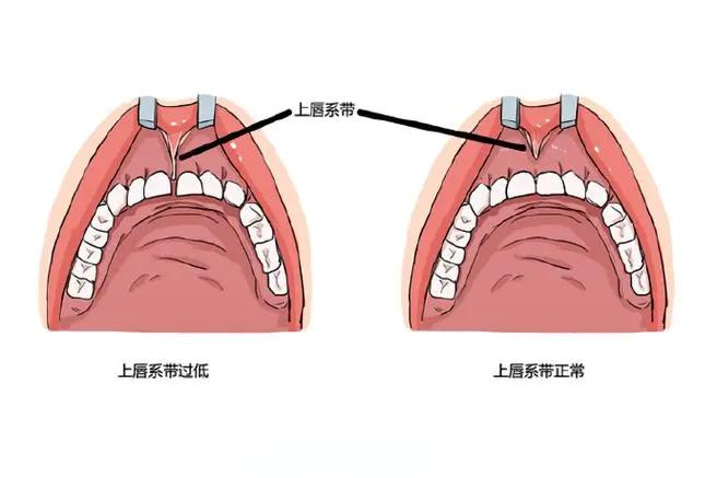 牙齿矫正九